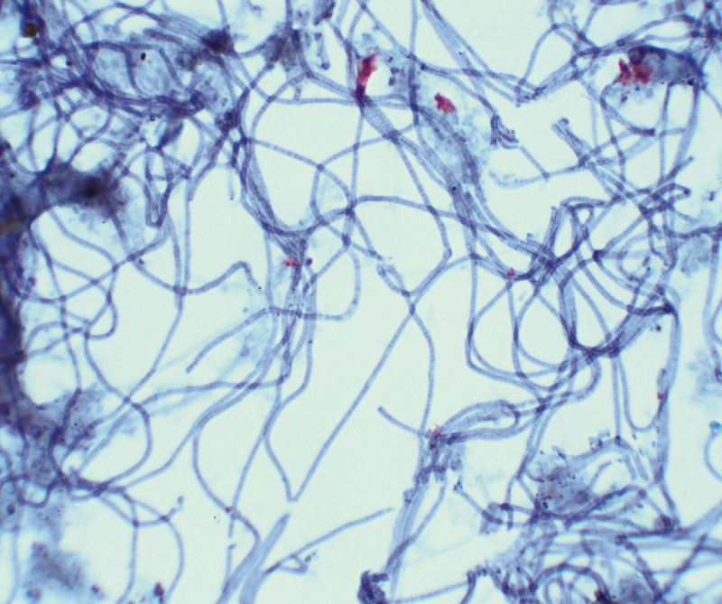 Mikroskopie des Fadenbakteriums Nostocoida limicola / Microscopy of filamentous bacteria Nostocoida limicola © BIOMONTAN GmbH