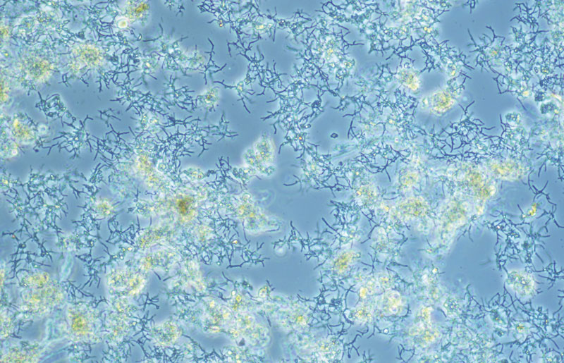 Mikroskopie des Fadenbakteriums Nocardioforme Actinomyceten / Microscopy of filamentous bacteria Nocardioform actinomycetes © BIOMONTAN GmbH