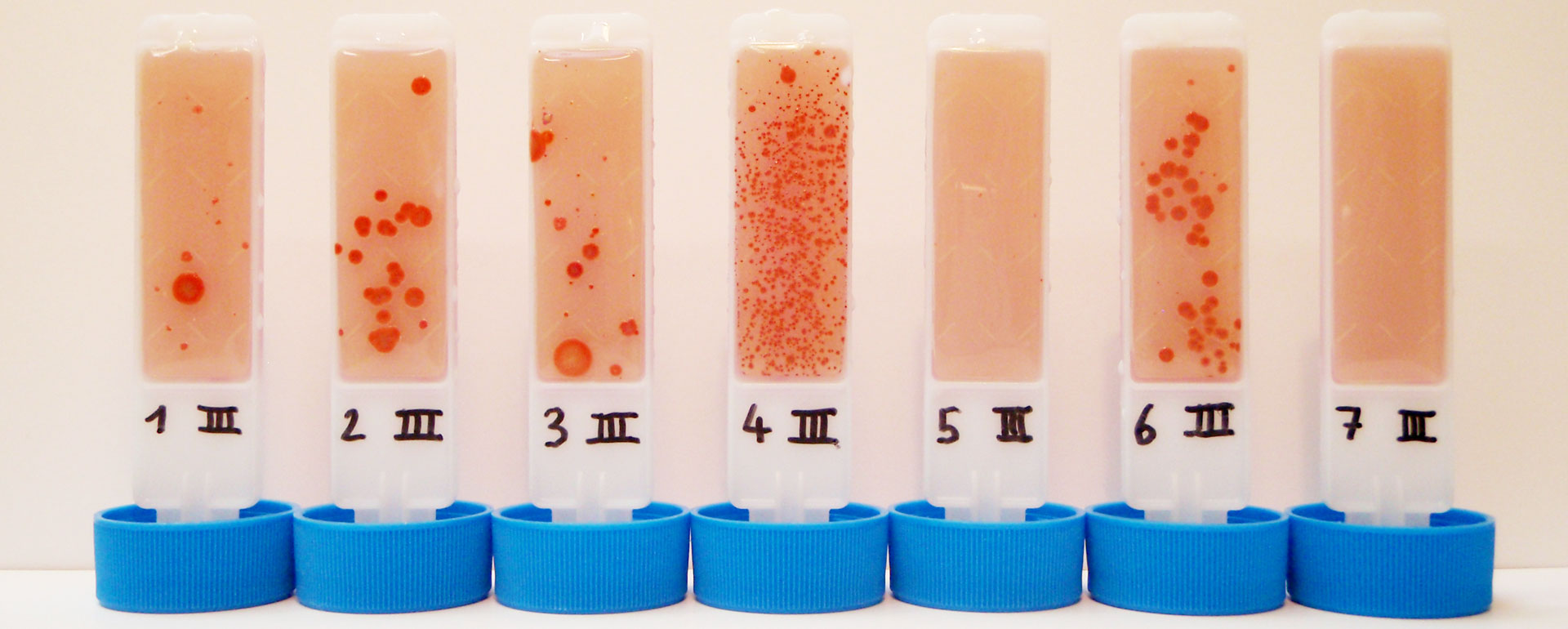 Keimzahl-Testreihe / Bacterial count test series © BIOMONTAN GmbH